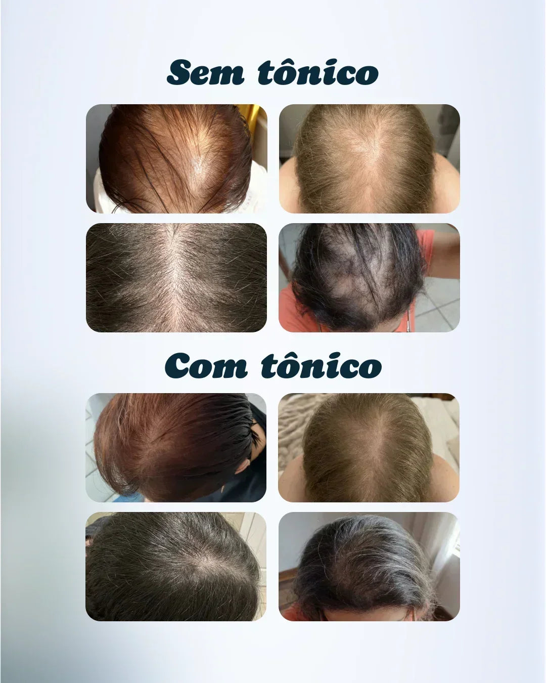 Combo de 2 Adonay Tônico Capilar