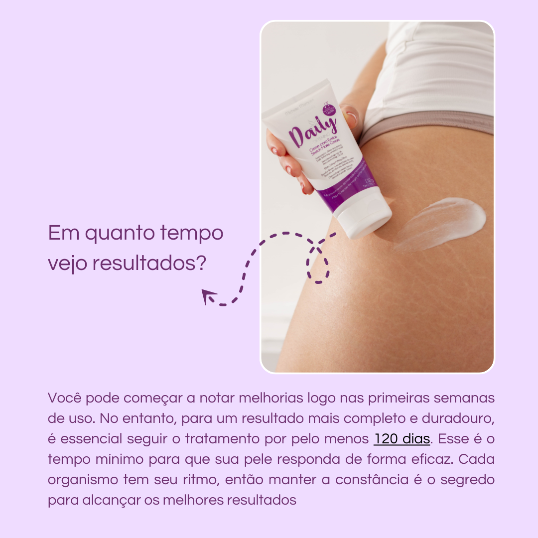 Compre 3 Ganhe 1 - Creme Para Estrias